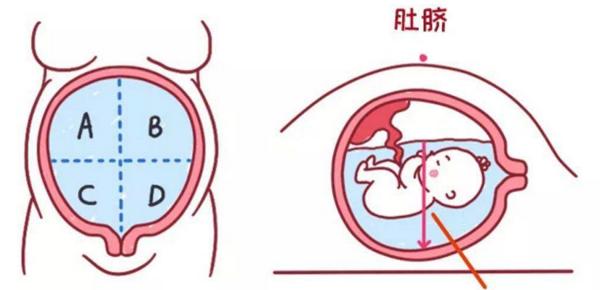 海洋国内助孕宝宝是什么